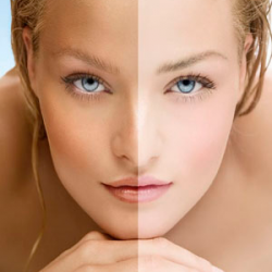 Despigmentante (Manchas)