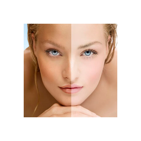 Despigmentante (Manchas)